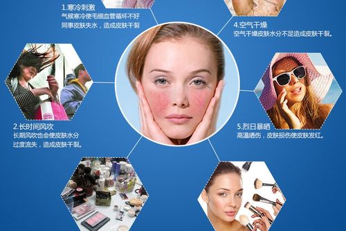 激素脸修复精华液 排毒舒敏去红血丝精华素