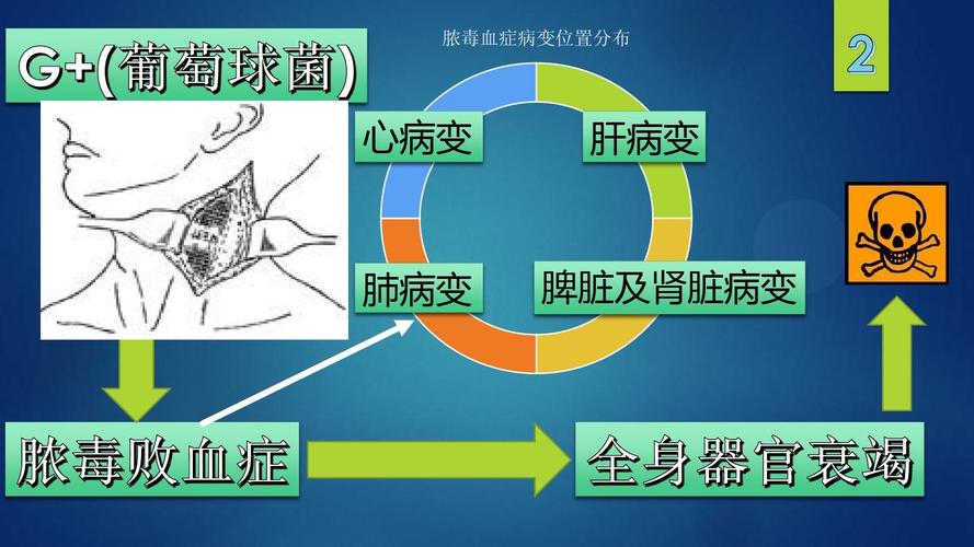 脓毒血症病例ppt