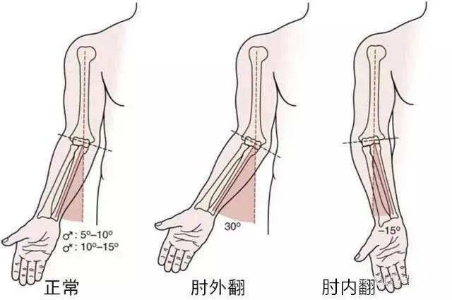 孩子你怎么胳膊肘朝外拐呢