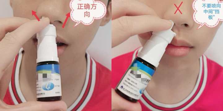 如何正确使用鼻喷剂?