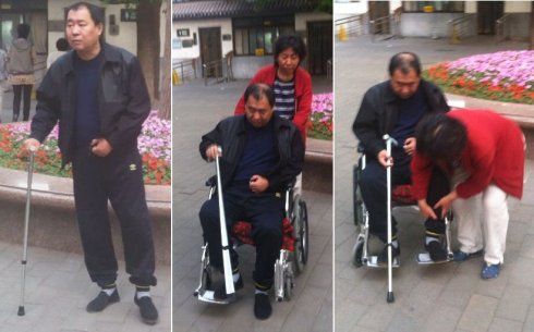 神经科 神经内科 中风后遗症 > 概述中风后遗症指中风偏瘫留下的最