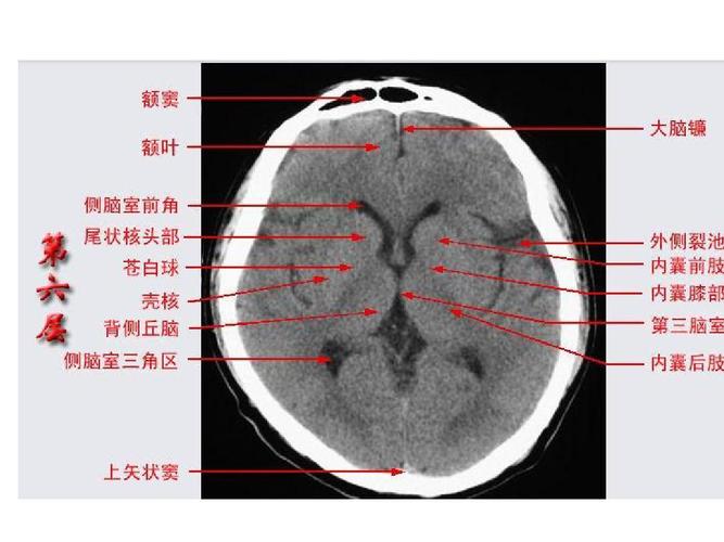 头颅ct影像解剖