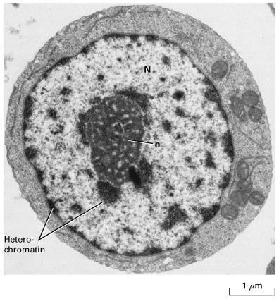  p>核仁(nucleolus) 通常表现为单一或多个匀质的球形小体,是 a href=