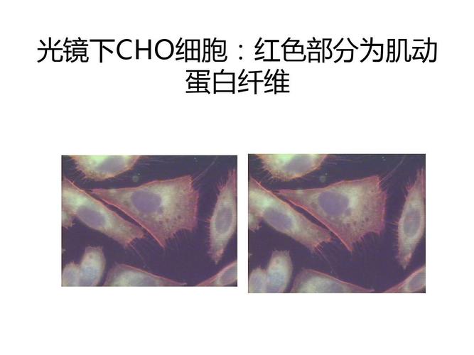医学细胞生物学 光镜下cho细胞:红色部分为肌动 蛋白纤维