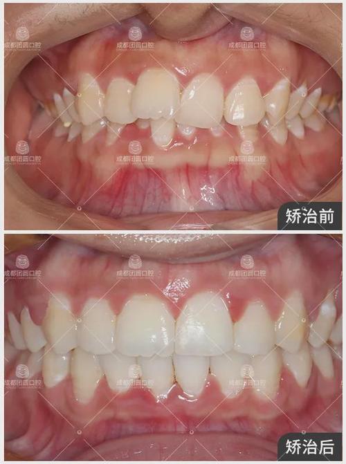 网友花式补牙欣赏有些钱还是让牙医赚吧