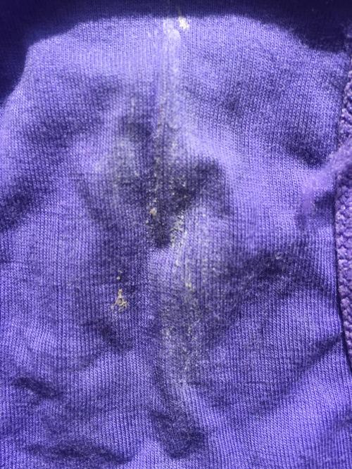 谁能告诉我这是精斑还是白带.