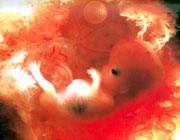 母腹中3个月的胎儿