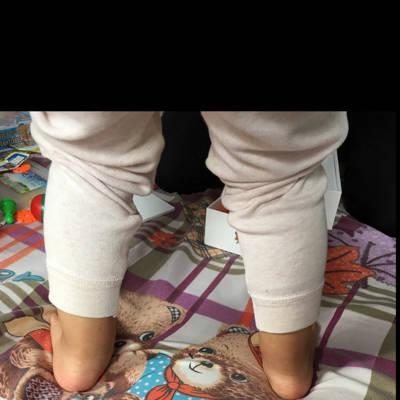 宝宝足外翻,今天去了医院,医生只是说让买个矫正鞋垫