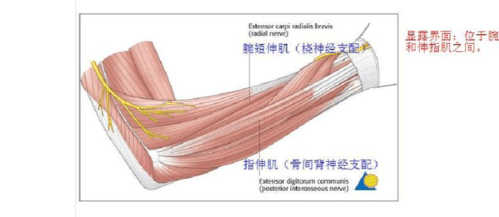 桡骨背外侧手术入路(thompson入路)