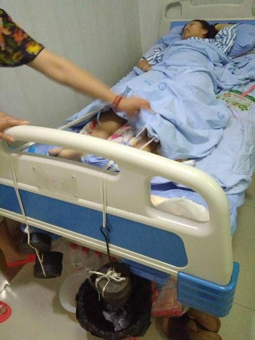 处理父亲后事途中遇车祸 川大女生双腿粉碎性骨折