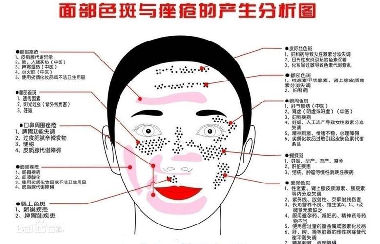 斑形的种类及形成原因