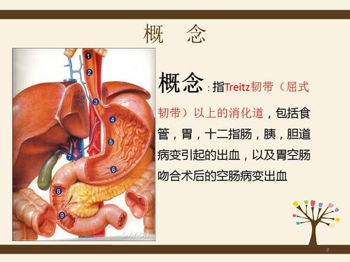 上消化道出血个案查房ppt演示课件.ppt