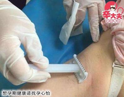 顺产时侧切的一刀与剖腹产的一刀有哪些区别?
