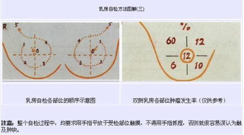 乳房自检