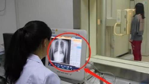 为什么女人害怕做"胸透",医生到底能看到什么?看完别