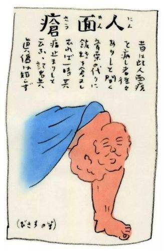 为什么他膝盖上生了个人面疮?