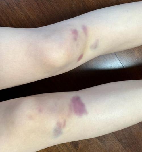 某s级女主播膝盖淤青斗鱼一姐停播去挖煤