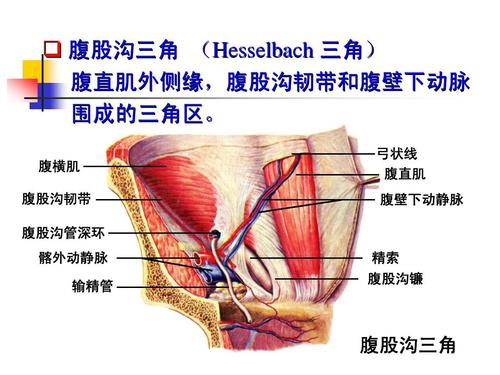 腹股沟三角 (hesselbach三角)腹直肌外侧缘,腹股沟韧带和腹壁下动脉