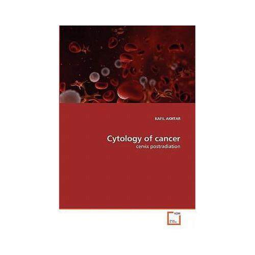 【预订】cytology of cancer