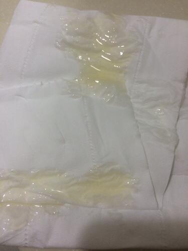 问:精液黄,感觉没了腥味,精液感觉不液化,早射,而且好像很长时间没