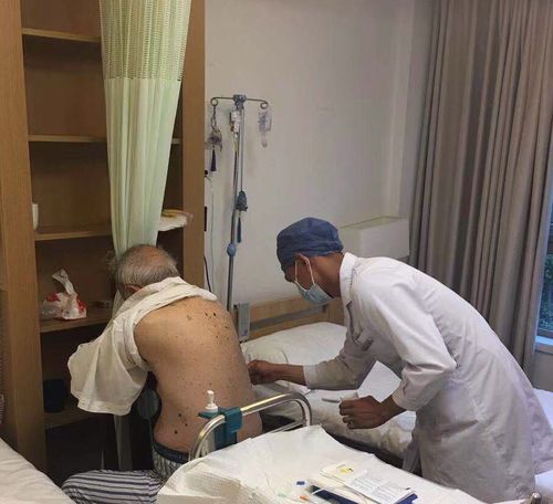 5月26日,浙一医院赶过来的赵医师为老父抽胸腔积液.