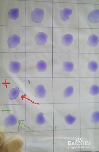 怎样测定鸡白痢抗体