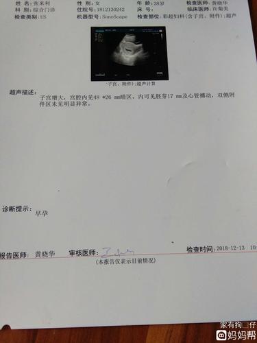 亲爱的宝妈们,这是孕八周的b超,医生说才