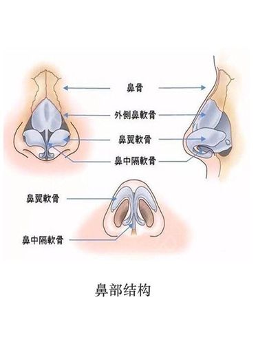两者互相挤压,导致鼻梁中间突起了一块骨组织和软骨,也就是鼓起了一个