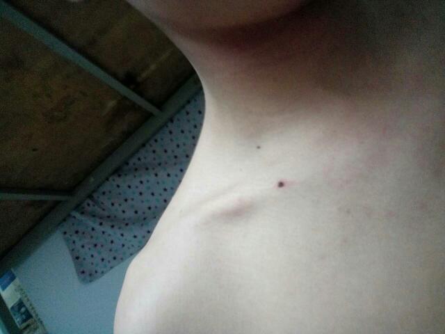 我是男生,锁骨边长一颗痣,代表什么?