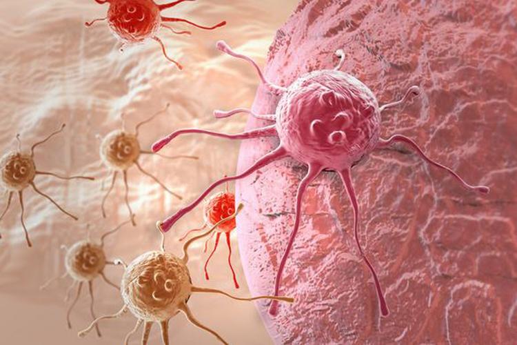 健康|"私人定制"癌症治疗,个体化应对肿瘤