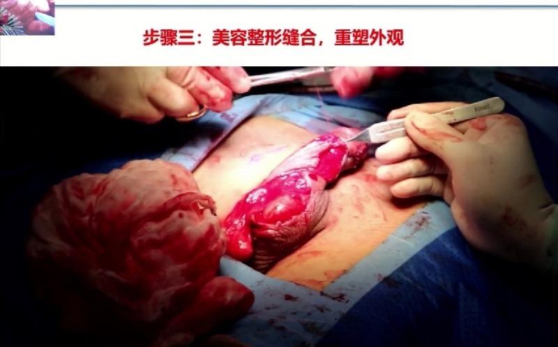 玉树林风的美篇