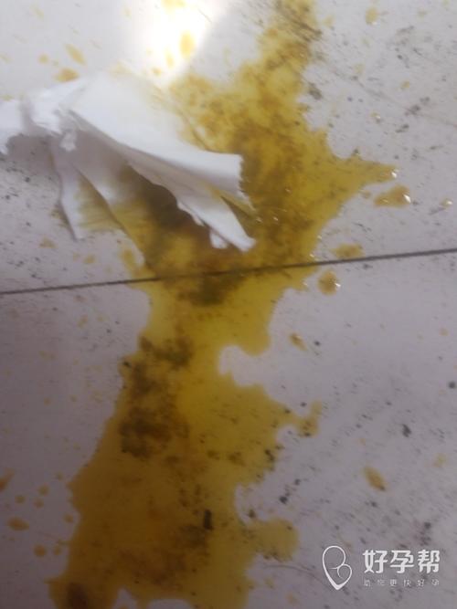 没有奶瓣,而且拉的量还多,次数也多,早起到现在拉了四次了