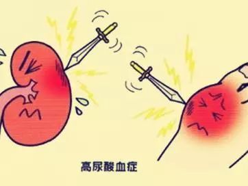 高尿酸血症与糖尿病密不可分