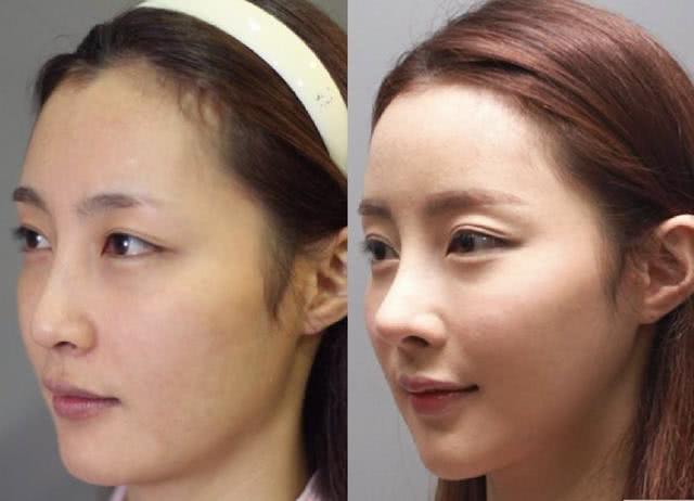 容易显老的女生,脸上一般有这4个特征,颧骨高,苹果肌扁平都中