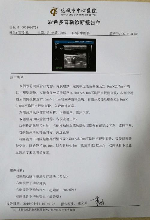 颈动脉超声波报告单