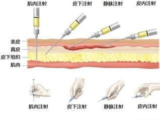 问:儿子要多次进行皮下注射,我打了针后,妻子跟人说起注射情况,人家说