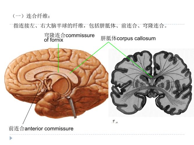 半卵圆中心.ppt