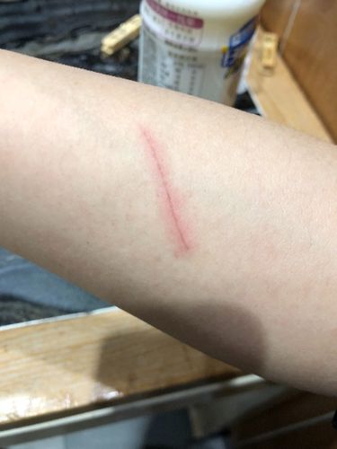 被小狗抓伤会的狂犬病吗?