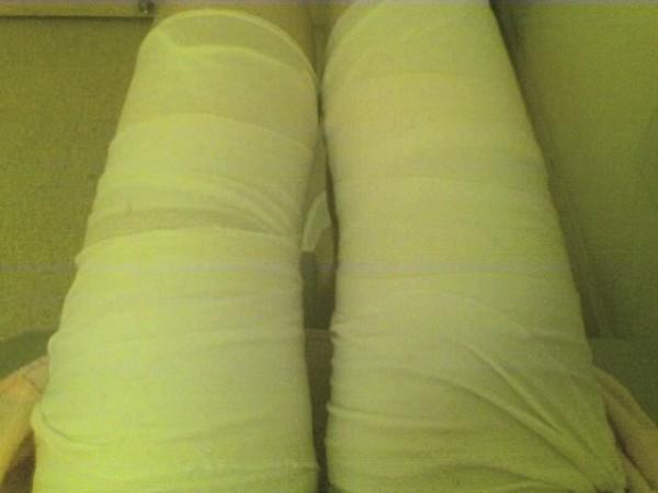 玛花纤体 感受瘦大腿冷绷带