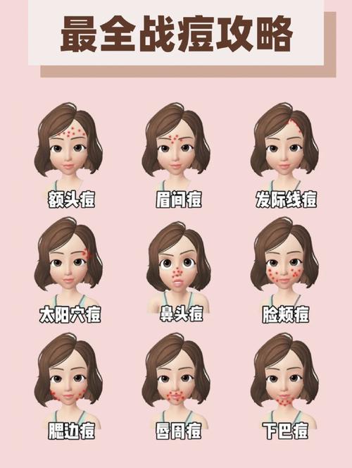 脸上长痘痘怎么办超详细的长痘原因剖析和痘痘saybye