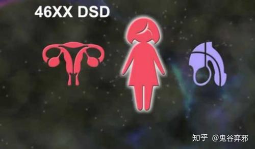46xydsd 基因属男性 性腺为男性睾丸,外生殖器官则有女性性征.