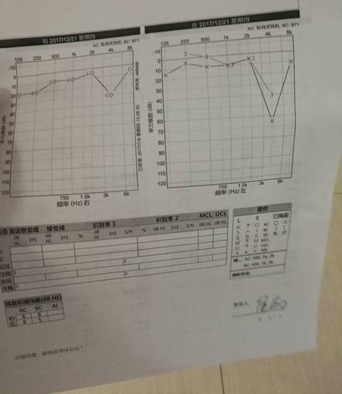 求这个听力图怎么看的