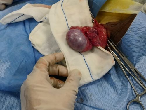 其它 蛋蛋的忧伤,家有男孩的需要注意了 写美篇       真实案例:大年