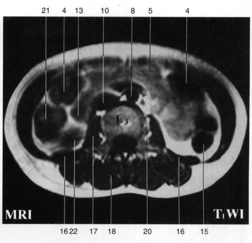 竖脊肌 erector spinae 19.马尾 cauda equina 20.