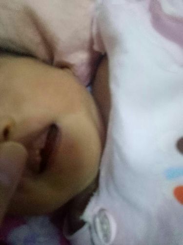 新生儿上牙龈中间有缺口这样有事吗