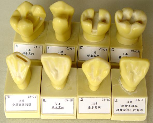 单色4倍大窝洞置备模型