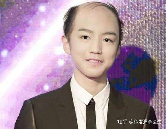 我们先来欣赏一下明星们秃头后的照片吧!当然都是p的.