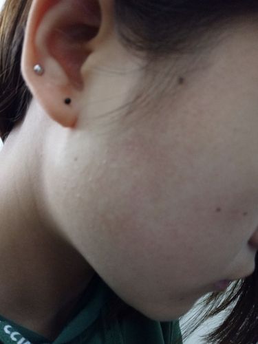 完了完了脸上的鸡皮肤,暗沉得很