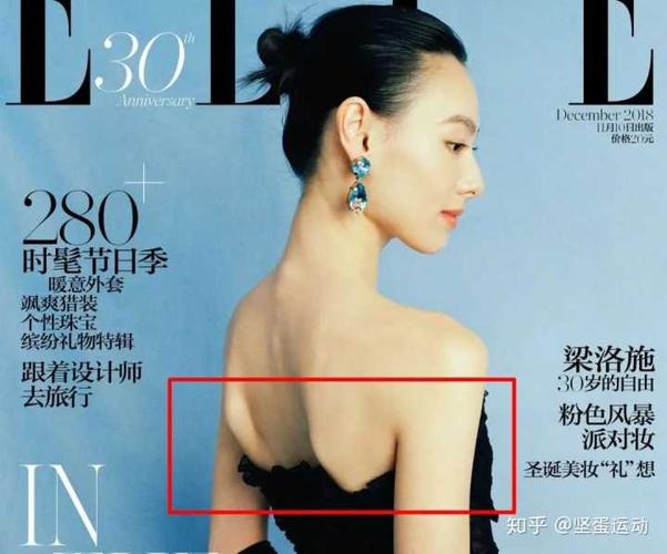 别以为翼状肩胛只会出现在消瘦的女明星,或是只出现在女性身上,作为