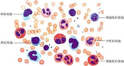 白细胞含量低怎么办 白细胞减少怎么回事